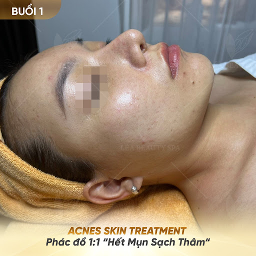 Léa Beauty Quận 2 photo 5 in Thao Dien