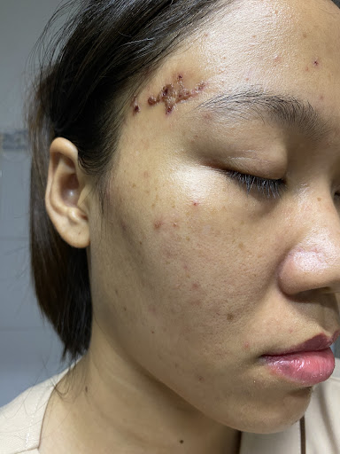 MILK SKIN BEAUTY | Spa Nặn Mụn Gần Đây | Gội Đầu Dưỡng Sinh Gần Đây | Spa Gần Đây photo 6 in Thao Dien