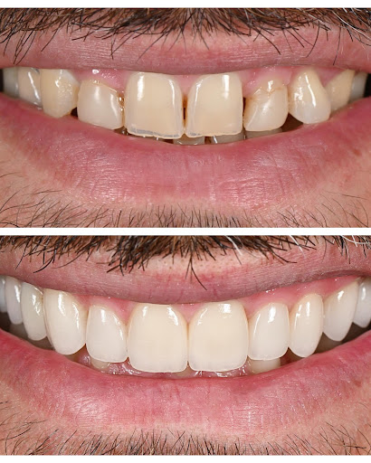 Ysmiles Dental Nha Khoa Thẩm Mỹ - Masteri An Phú- Q.2 photo 4 in Thao Dien
