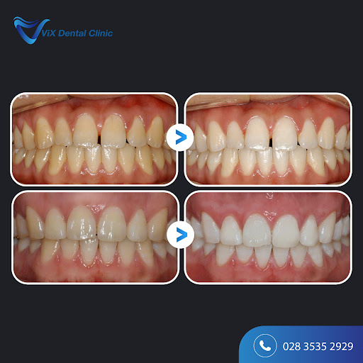 VIX Dental Clinic(빅스 치과) - Nha Khoa VIX - 호치민 치과 photo 6 in Thao Dien